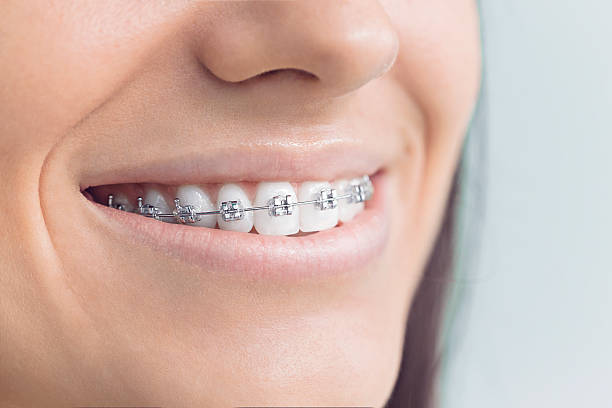 Best Traditional Braces  in Oceanside, NY